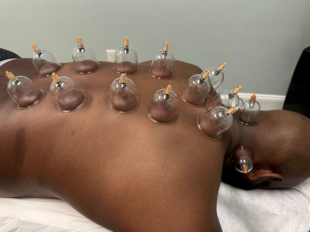 Dry Cupping